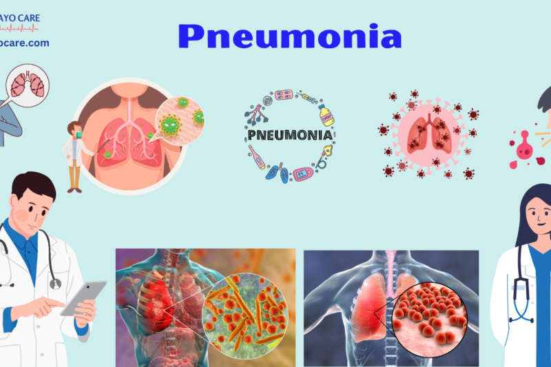 Pneumonia causes, symptoms, prevention and treatment